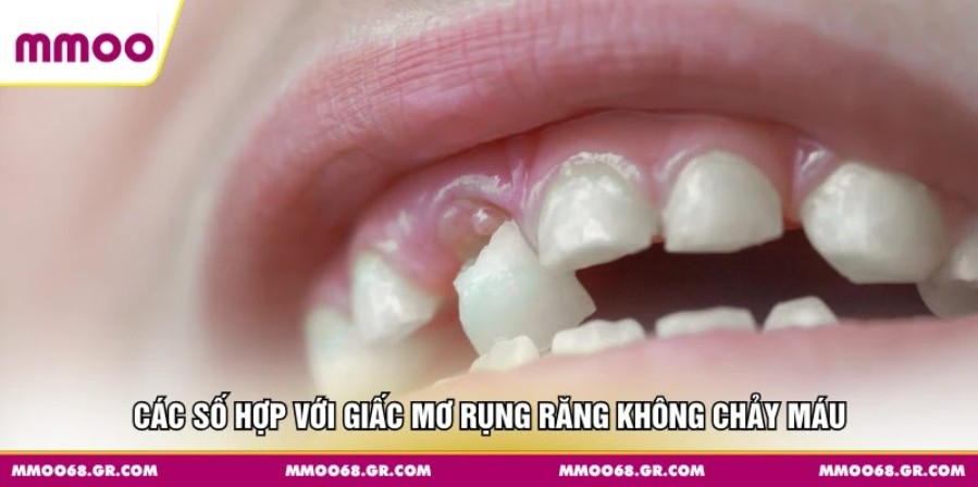 Các số hợp với giấc mơ rụng răng không chảy máu