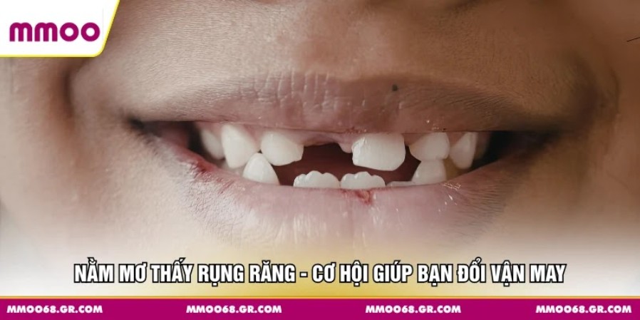 Nằm Mơ Thấy Rụng Răng - Cơ Hội Giúp Bạn Đổi Vận May